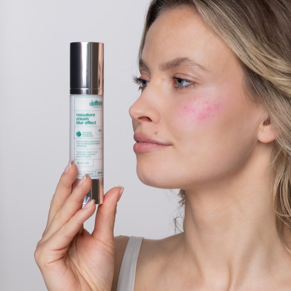 Modelka z zaczerwienionym policzkiem trzyma Rossatore Cream Blur Effect
