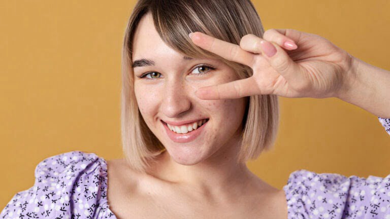 skóra naczynkowa,rumień,pękające naczynka,skóra wrażliwa |